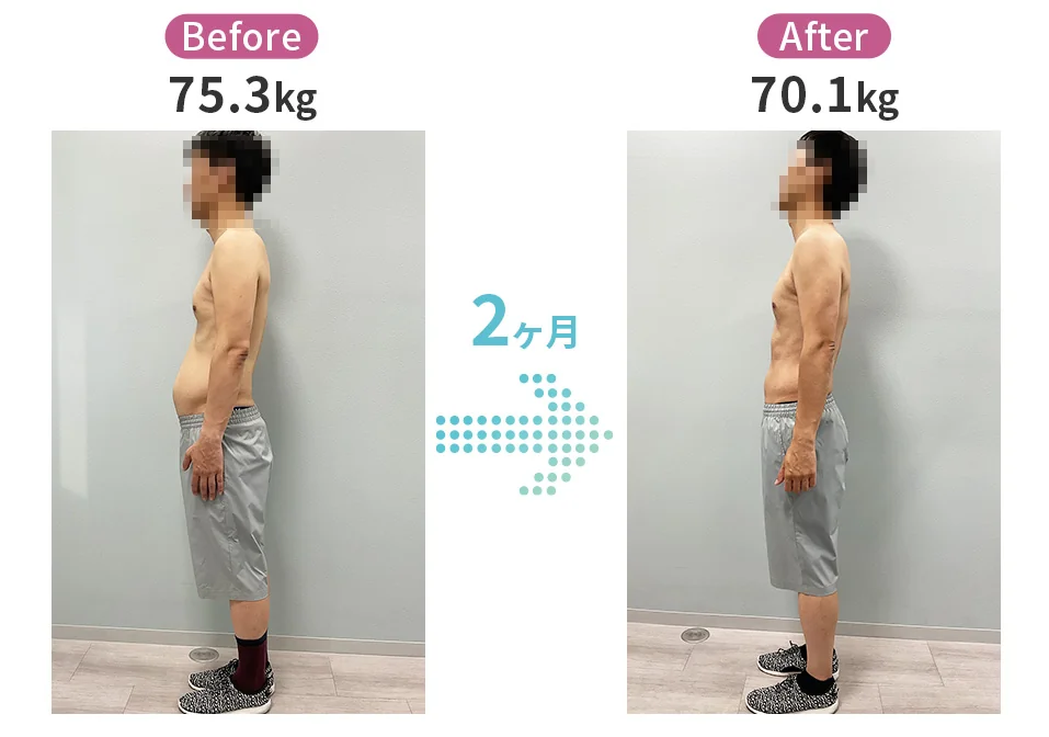 2ヶ月で75.3kgから70.1kgになった男性の横姿のビフォーアフター
